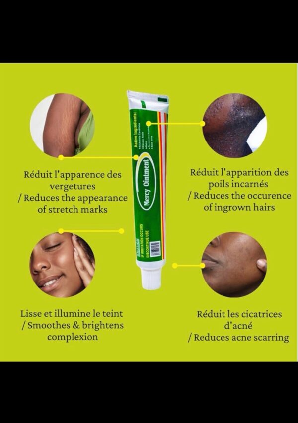 Crème Mercyointment (30g)